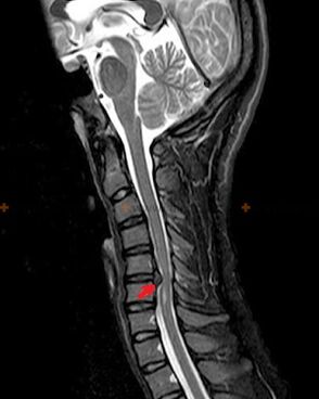 X-ray of the spine
