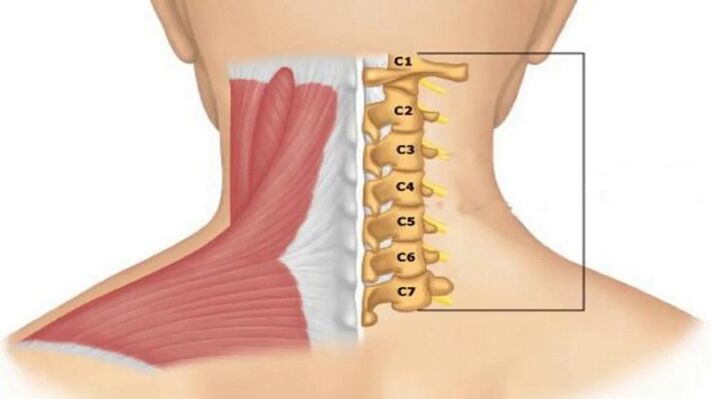 Radicular syndrome manifests itself depending on which vertebra compresses the nerve endings